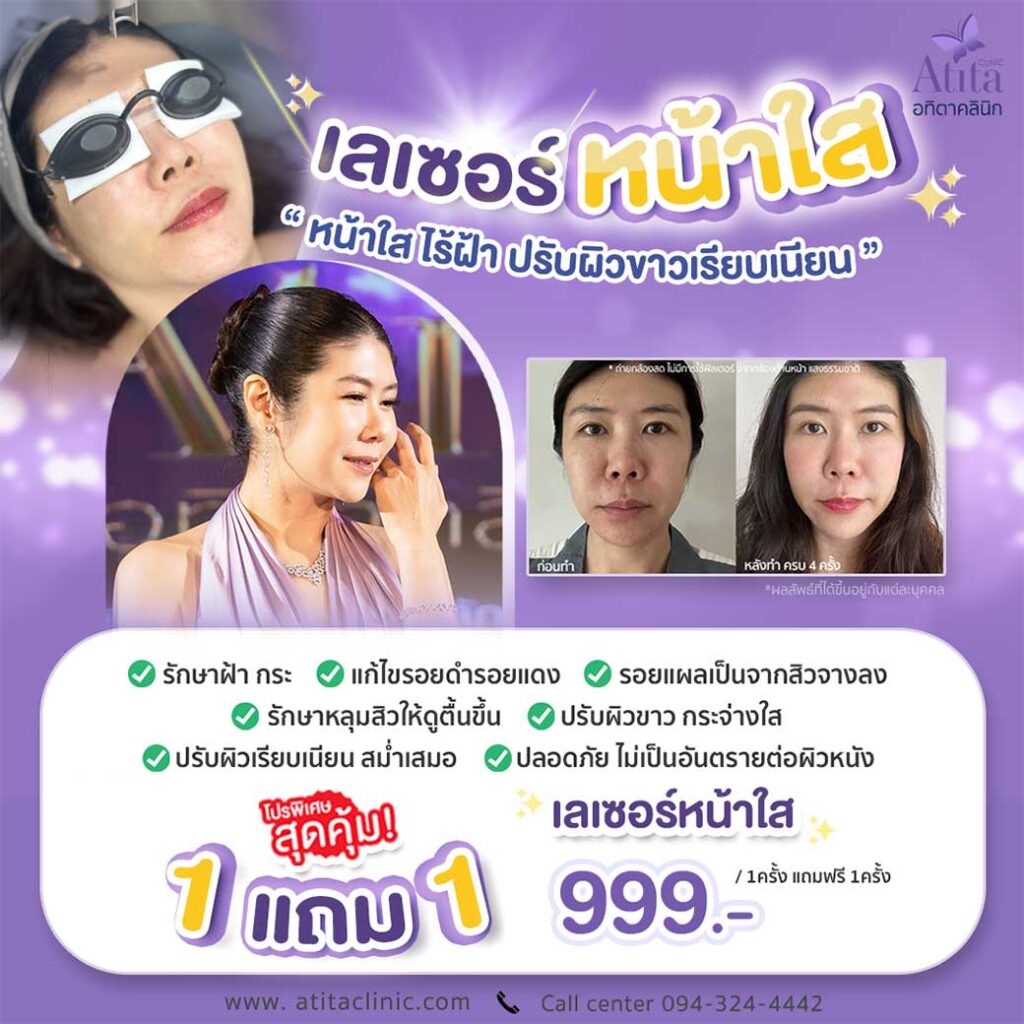 โปรโมชั่น-Lase-เลเซอร์-ราคาถูก-คลินิก-กรุงเทพ