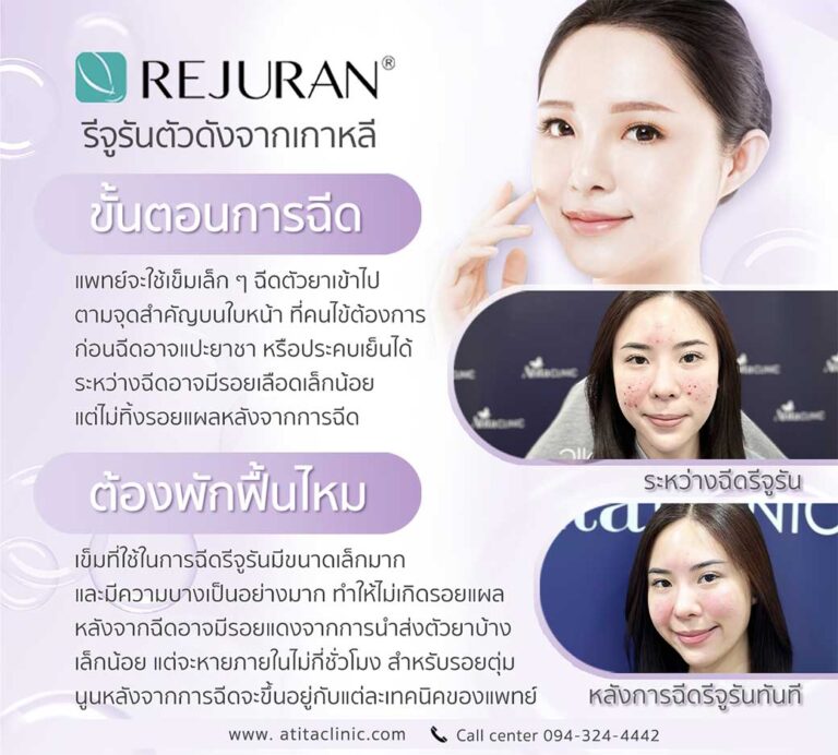 Rejuran ช่วยให้ผิวใส เหมาะกับใคร กี่วันเห็นผล