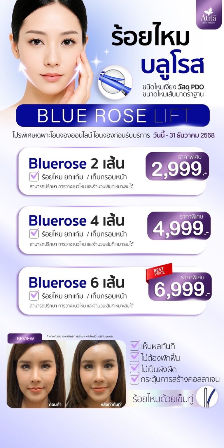 รีวิว-ร้อยไหม-ปรับรูปหน้ายกกระชับ-ใช้ไหมกี่เส้น-เห็นผลแค่ไหน-ไหม-Blue-Rose