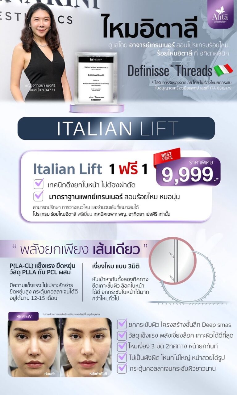 รีวิว-ร้อยไหม-ปรับรูปหน้ายกกระชับ-ใช้ไหมกี่เส้น-เห็นผลแค่ไหน-ไหม-ittaly-ไหม-อิตาลี
