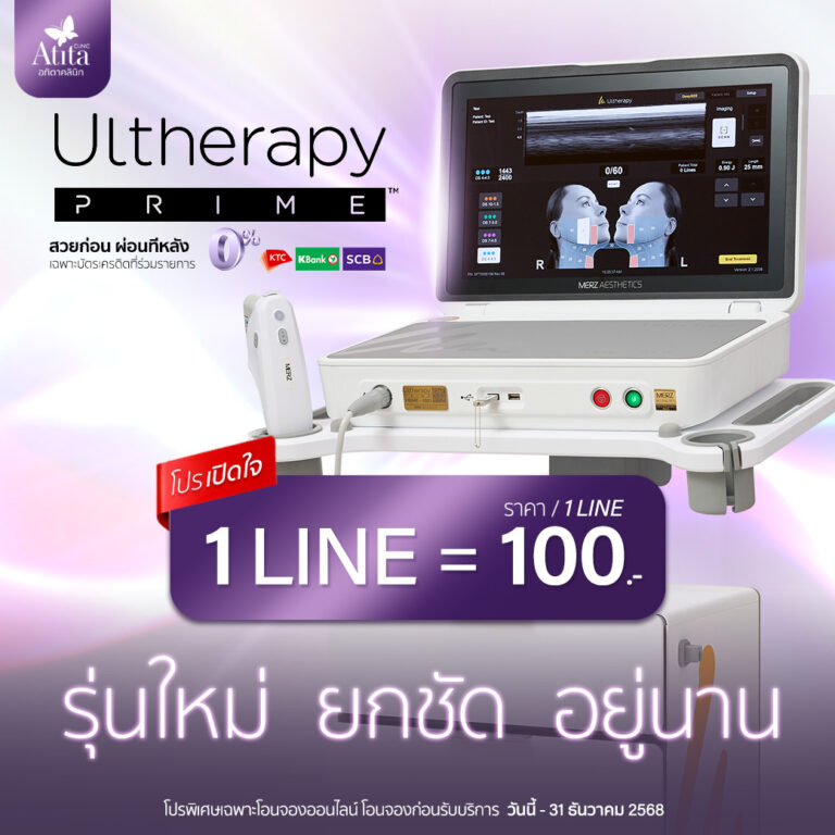 อัลเทอร่าไพร์ม Ulthera Prime ราคาถูก โปรโมชั่น อทิตาคลินิก